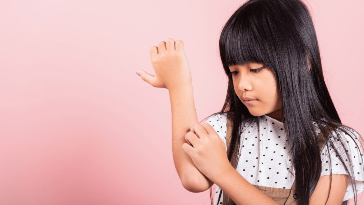 Dermatite atopica nei bambini: come riconoscerla e curarla
