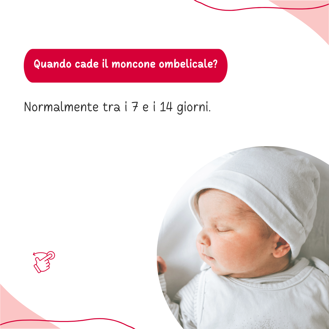 Ombelico neonato: pulizia, cura , caduta, infezioni del moncone